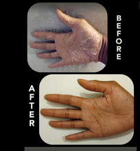 Load image into Gallery viewer, Eczema Relief by Par'-Aqua Holistic Health